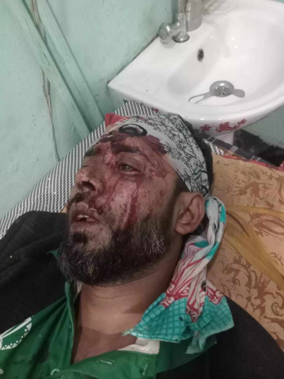 লক্ষ্মীপুরে যুবলীগ নেতাকে কুপিয়ে জখম করে ছাত্রদলের সন্ত্রাসীরা খুবই আশঙ্কাজনক