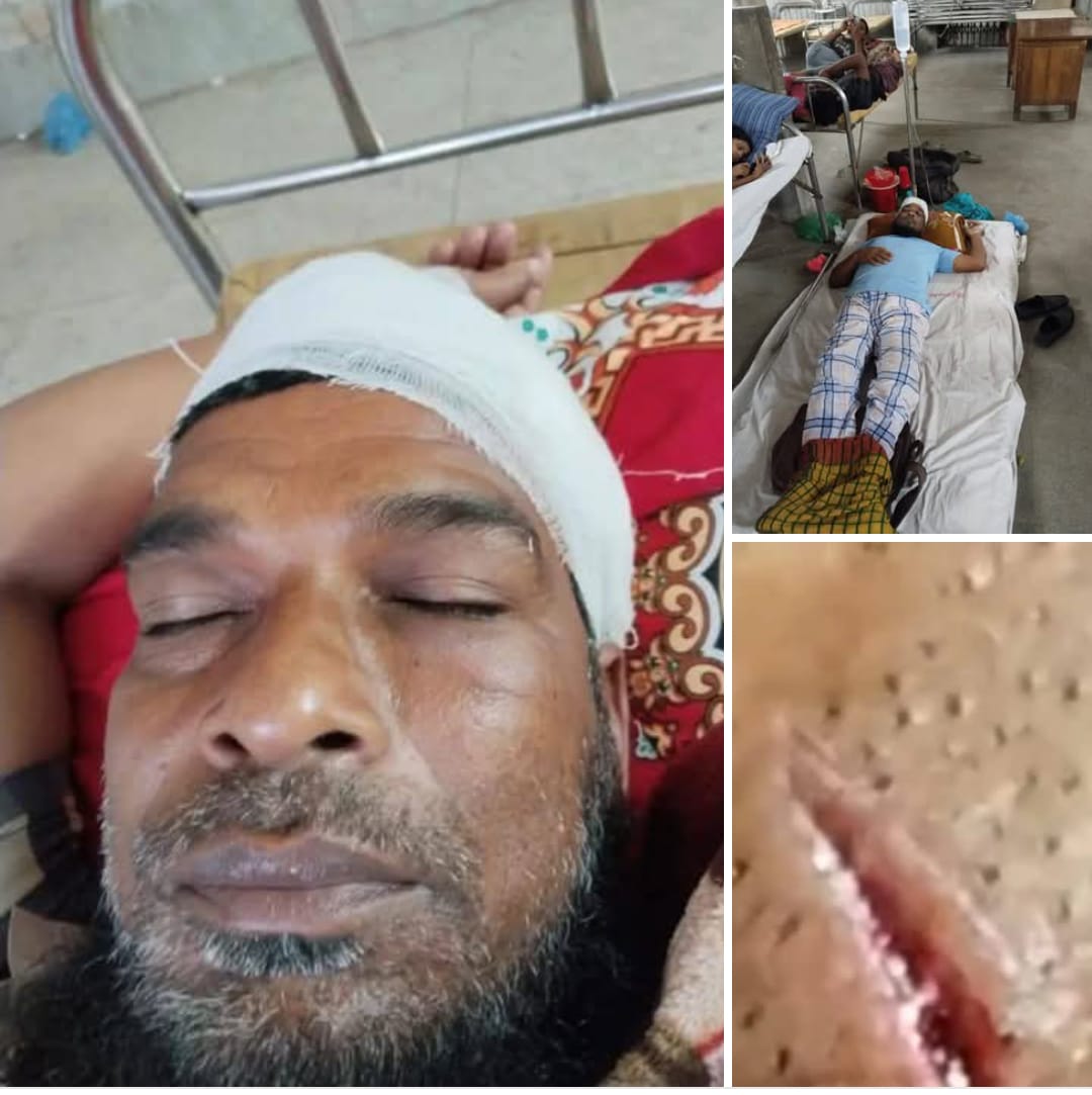 গলাচিপায় শারীরিক প্রতিবন্ধীকে কুপিয়ে জখম, থানায় মামলা নিতে ওসির গরিমসি